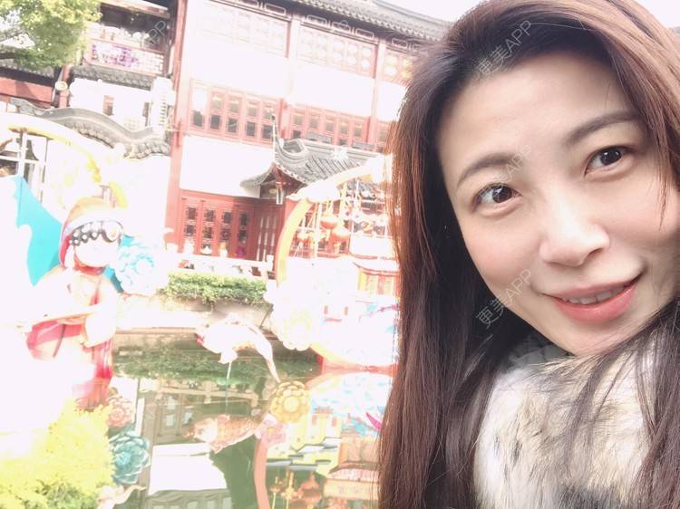 更美 - 更美用户bONdGip4QS的双眼皮经验 | 双眼皮 | 上海 | 眼部多项