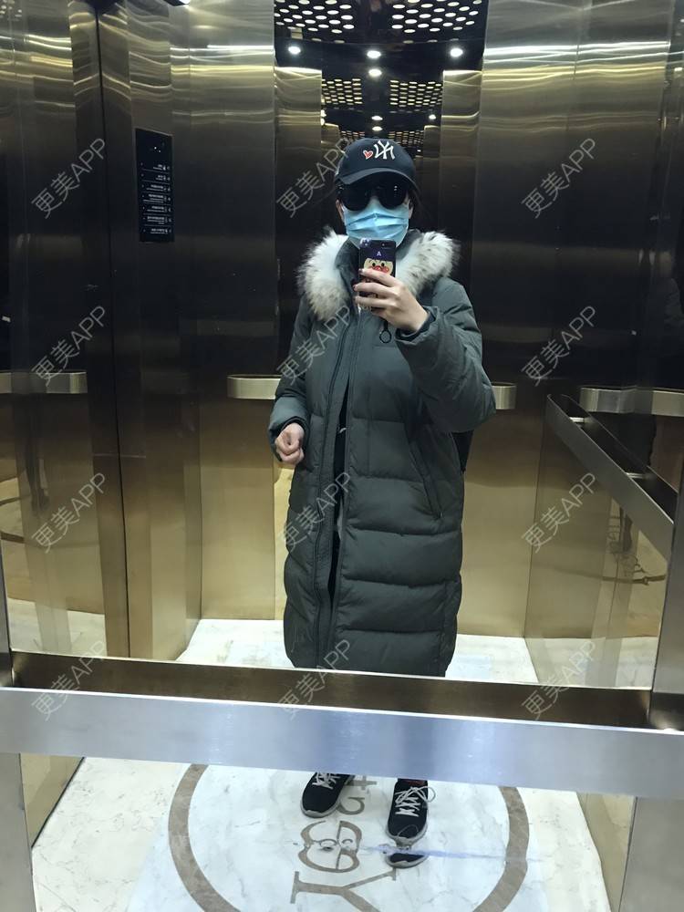 更美 - 更美用户bONdGip4QS的双眼皮经验 | 双眼皮 | 上海 | 眼部多项