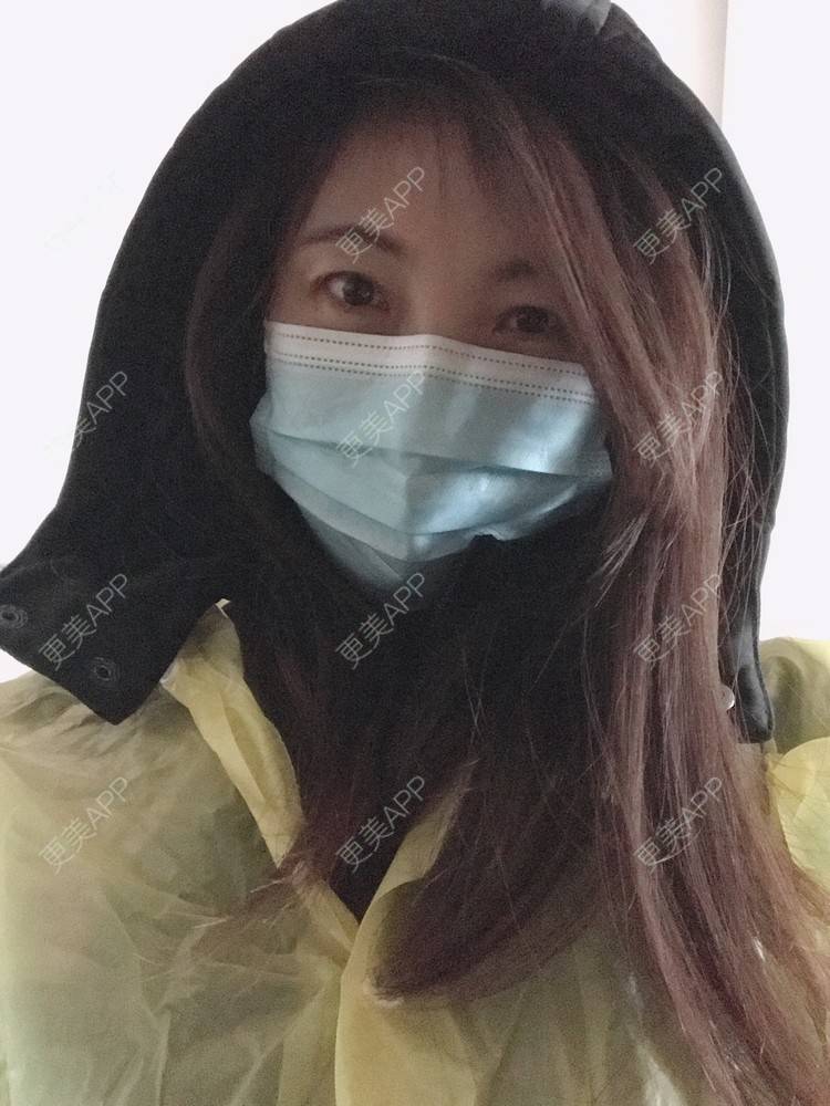 更美 - 更美用户bONdGip4QS的双眼皮经验 | 双眼皮 | 上海 | 眼部多项