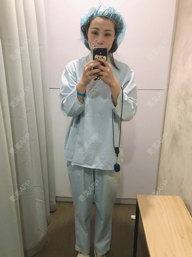 更美 - 更美用户bONdGip4QS的双眼皮经验 | 双眼皮 | 上海 | 眼部多项