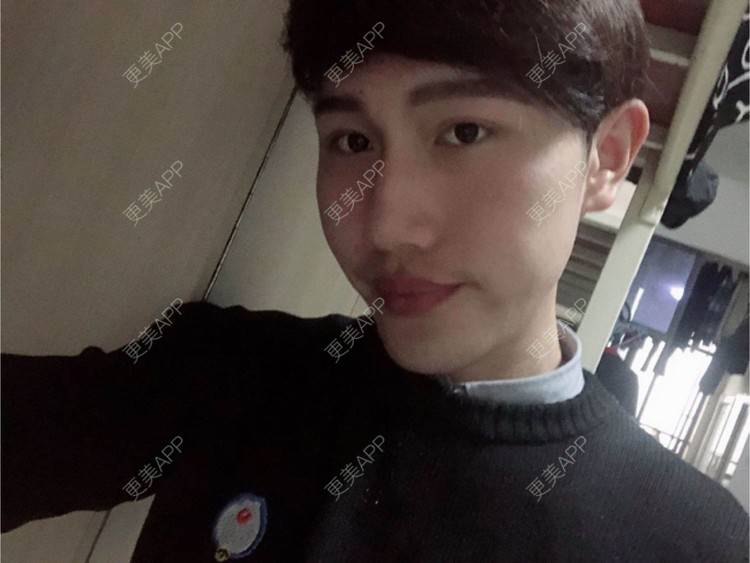 更美 - D调··的植发际线经验 | 成都