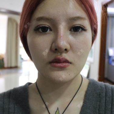 陈玉琼 医生