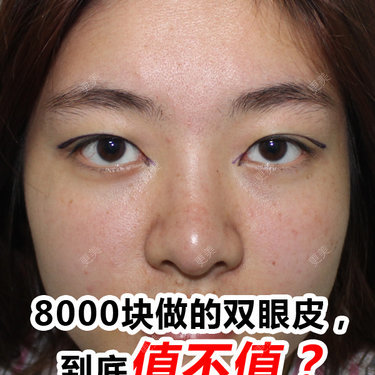 陈玉琼 医生
