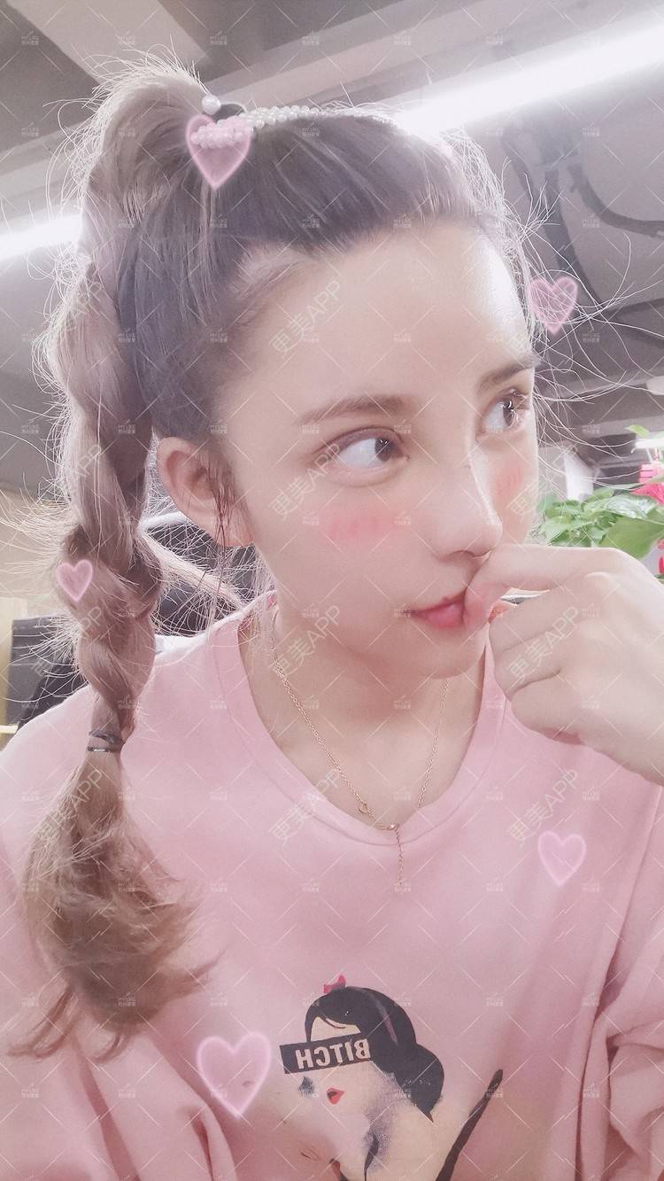 更美 - 土豆泥泥泥的双眼皮经验 | 双眼皮 | 隆鼻 | 苏州 | 自体脂肪面部填充