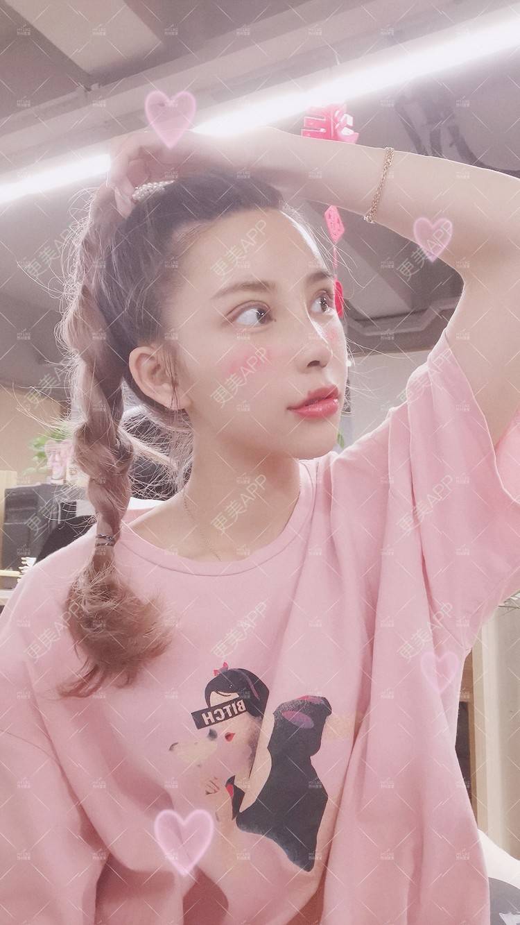 更美 - 土豆泥泥泥的双眼皮经验 | 双眼皮 | 隆鼻 | 苏州 | 自体脂肪面部填充