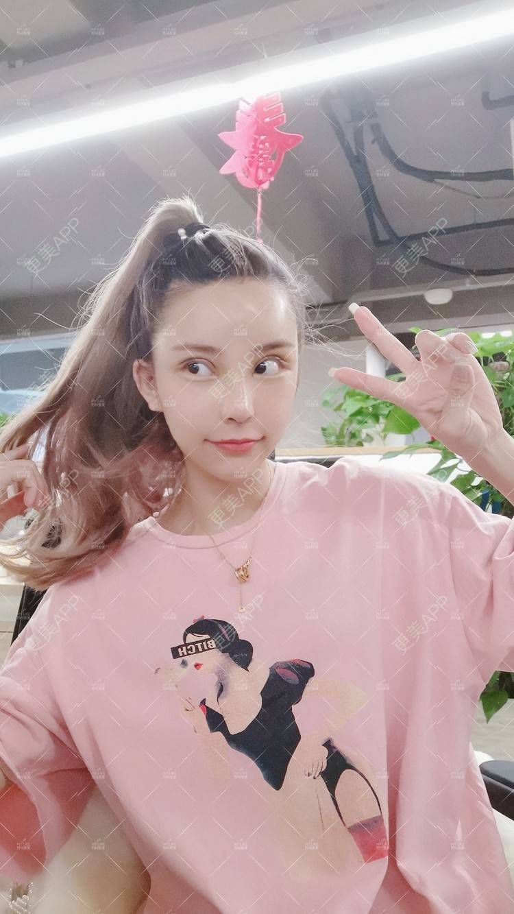 更美 - 土豆泥泥泥的双眼皮经验 | 双眼皮 | 隆鼻 | 苏州 | 自体脂肪面部填充