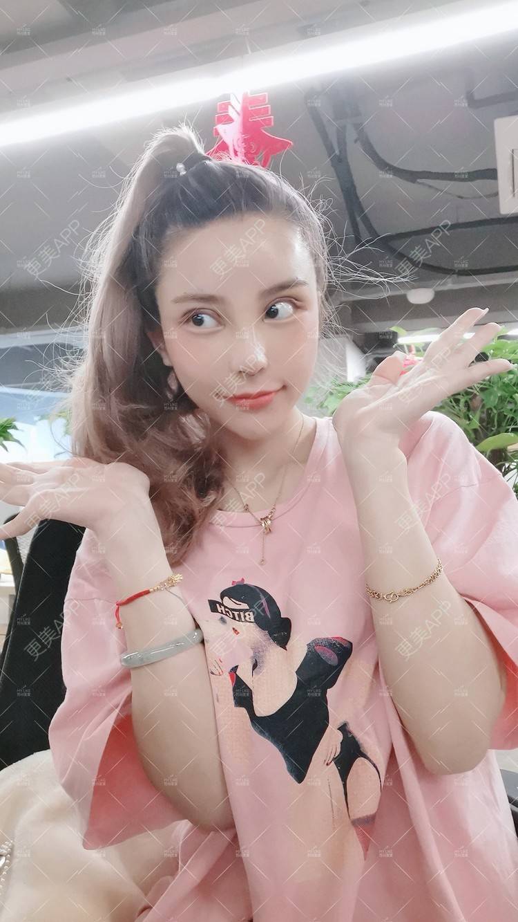 更美 - 土豆泥泥泥的双眼皮经验 | 双眼皮 | 隆鼻 | 苏州 | 自体脂肪面部填充