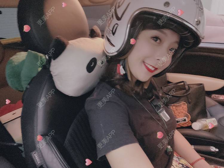 更美 - 更美用户9Nt11KbhXj的自体脂肪全面部填充经验 | 广州 | 自体脂肪全面部填充 | 视频日记
