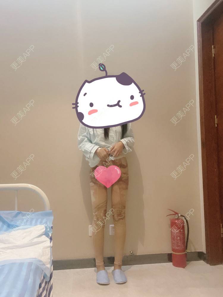 更美 - 更美用户mKvVnn0q0q的假体丰臀经验 | 假体丰臀 | 深圳
