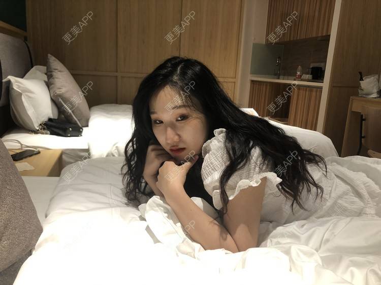更美 - 荏苒时光岁月如梭的鼻部多项经验 | 鼻部多项 | 肋软骨隆鼻 | 重庆 | 鼻小柱延长