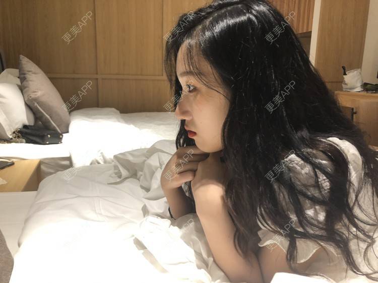 更美 - 荏苒时光岁月如梭的鼻部多项经验 | 鼻部多项 | 肋软骨隆鼻 | 重庆 | 鼻小柱延长