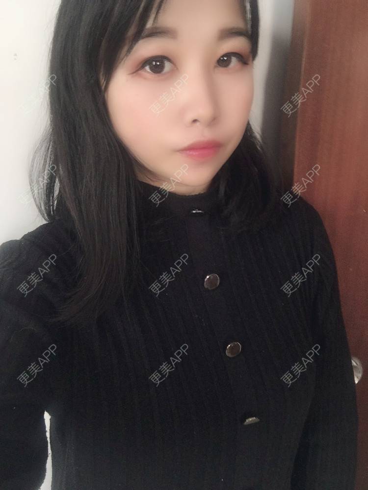 更美 - 我不知怎么说呀的鼻部多项经验 | 鼻部多项
