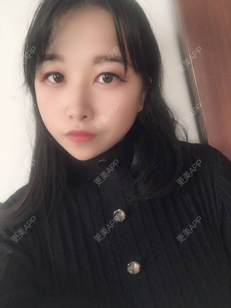 更美 - 我不知怎么说呀的鼻部多项经验 | 鼻部多项