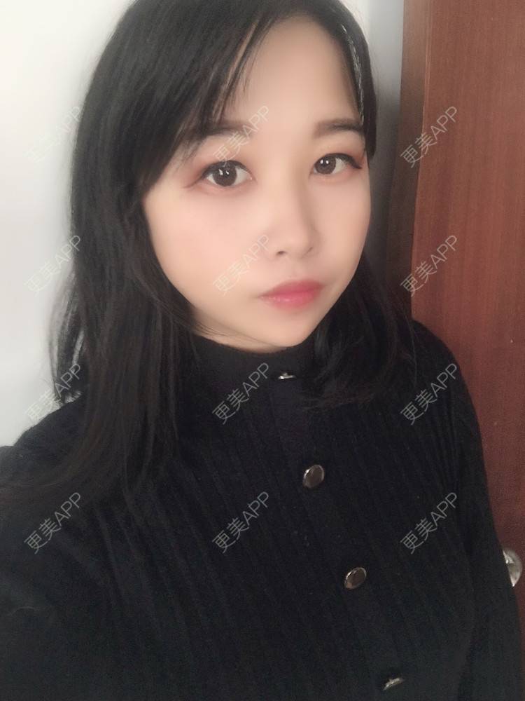 更美 - 我不知怎么说呀的鼻部多项经验 | 鼻部多项