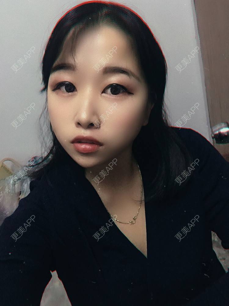 更美 - 我不知怎么说呀的鼻部多项经验 | 鼻部多项