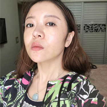 更美用户HZtGeH6Jqi