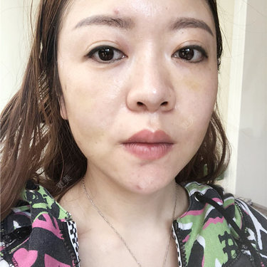 更美用户HZtGeH6Jqi