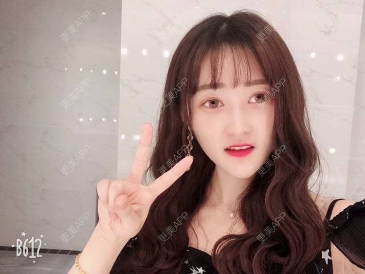 更美 - 南昌韩美美容医院的定点双眼皮经验 | 定点双眼皮 | 南昌