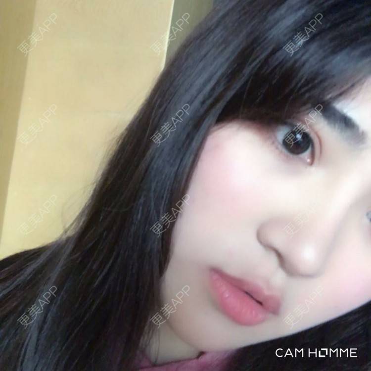 更美 - 南昌韩美美容医院的定点双眼皮经验 | 定点双眼皮 | 南昌