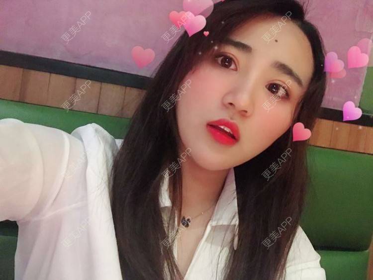 更美 - 南昌韩美美容医院的定点双眼皮经验 | 定点双眼皮 | 南昌