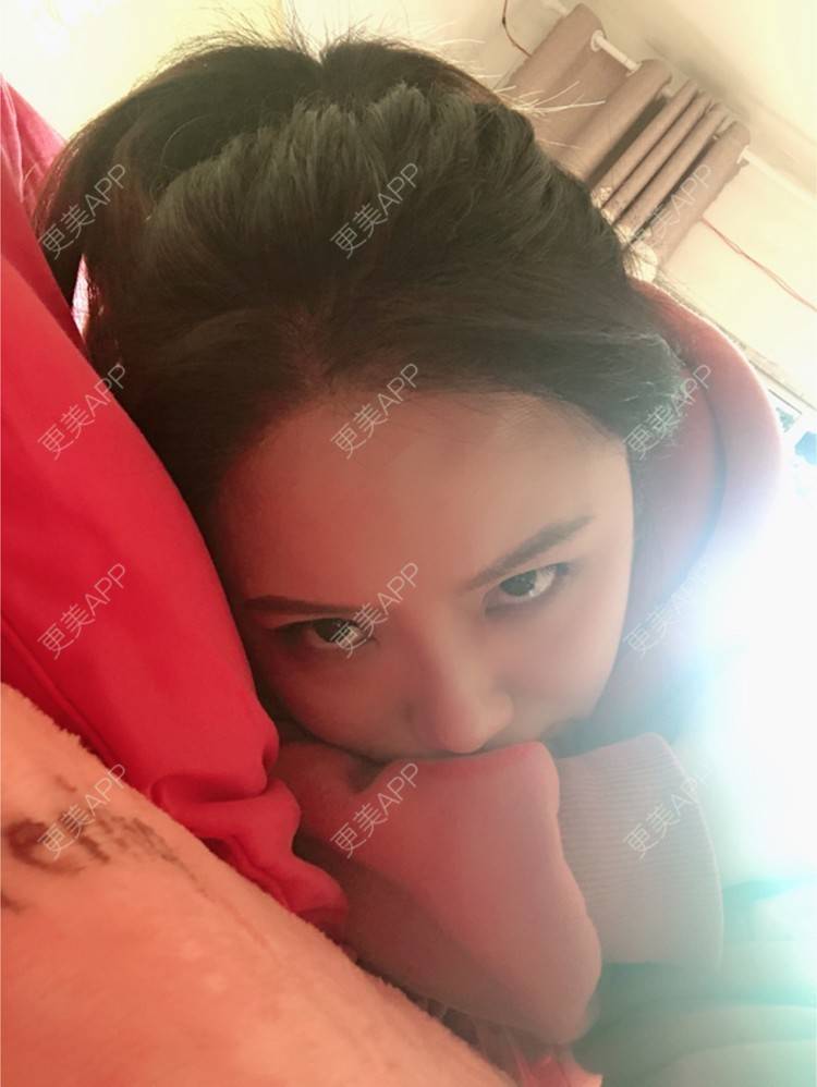 更美 - 奥多Ke。的植发际线经验 | 植发际线 | 南昌