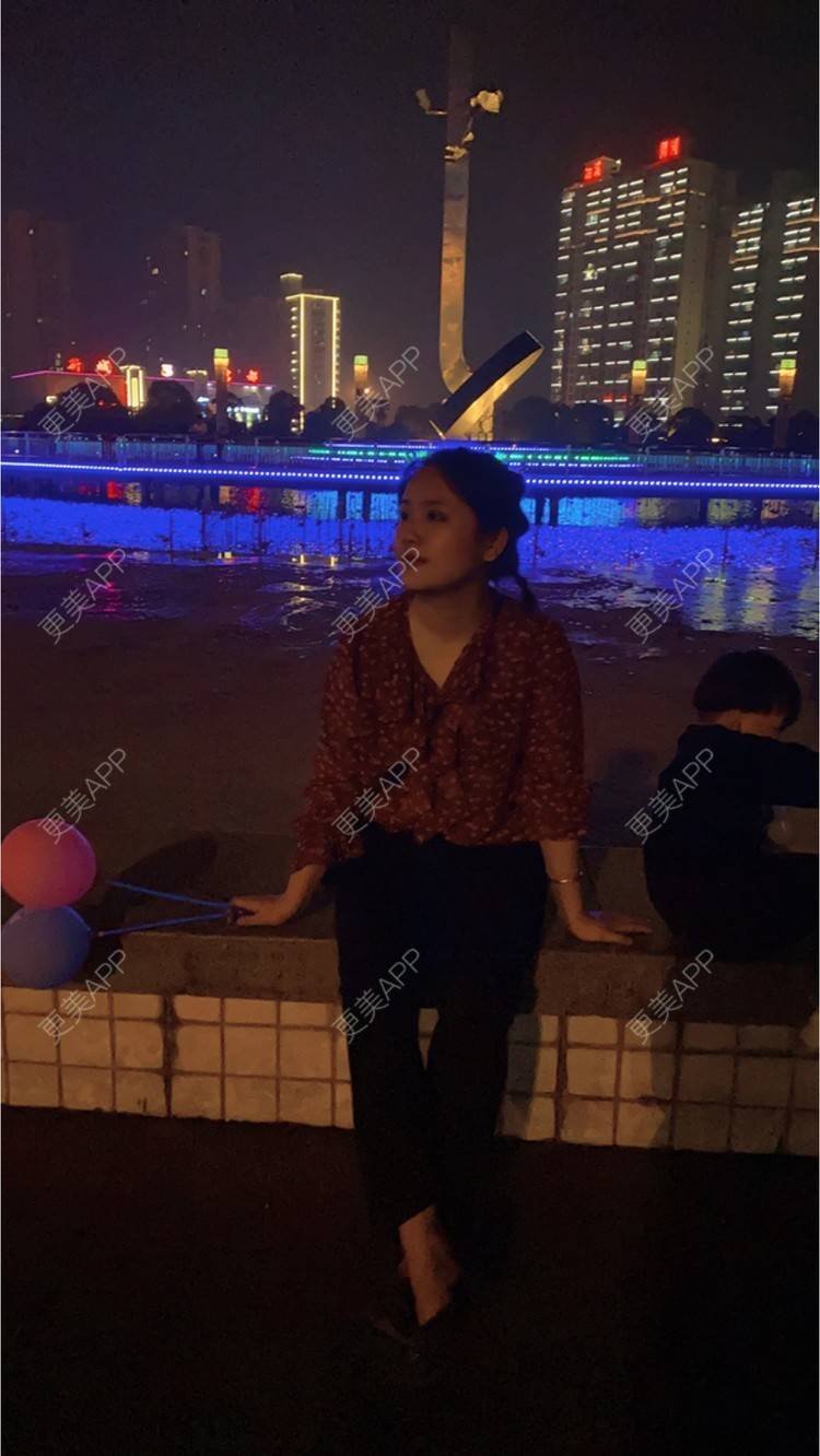 更美 - 奥多Ke。的植发际线经验 | 植发际线 | 南昌