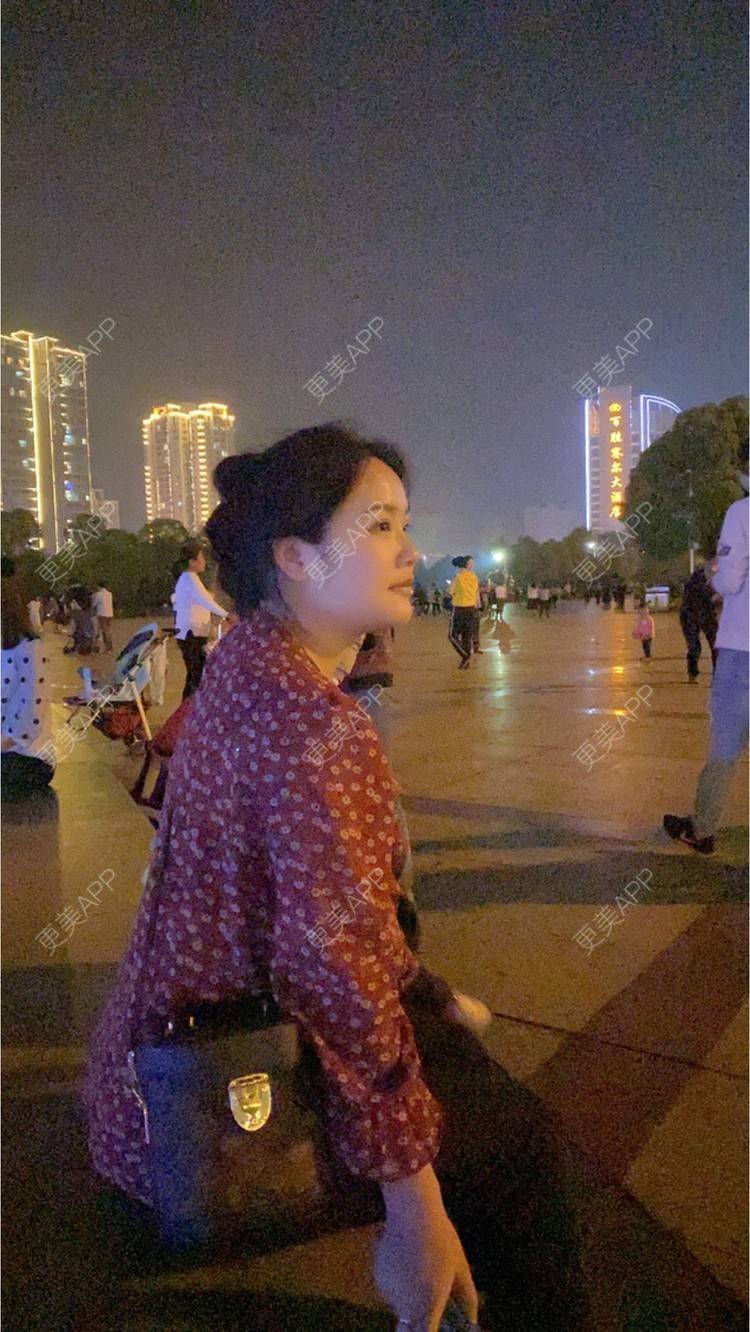 更美 - 奥多Ke。的植发际线经验 | 植发际线 | 南昌