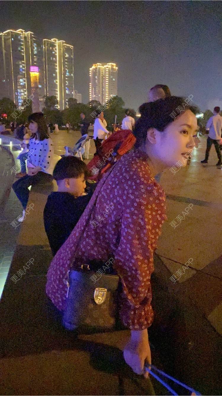 更美 - 奥多Ke。的植发际线经验 | 植发际线 | 南昌