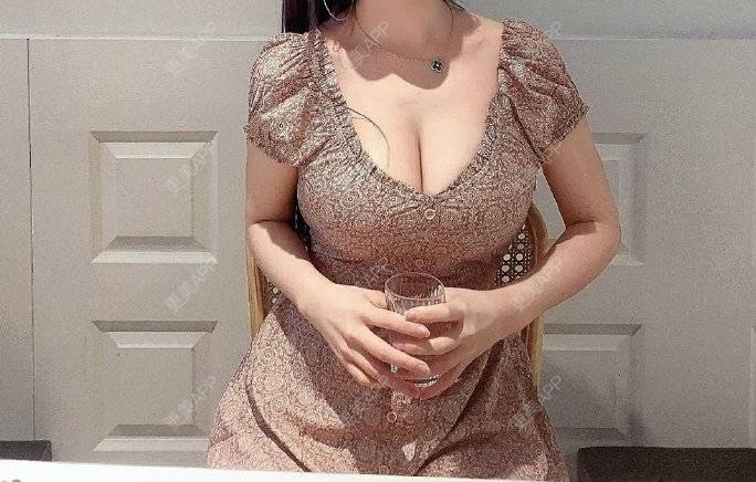 更美 - 杨小姐1的假体隆胸经验 | 假体隆胸 | 南昌