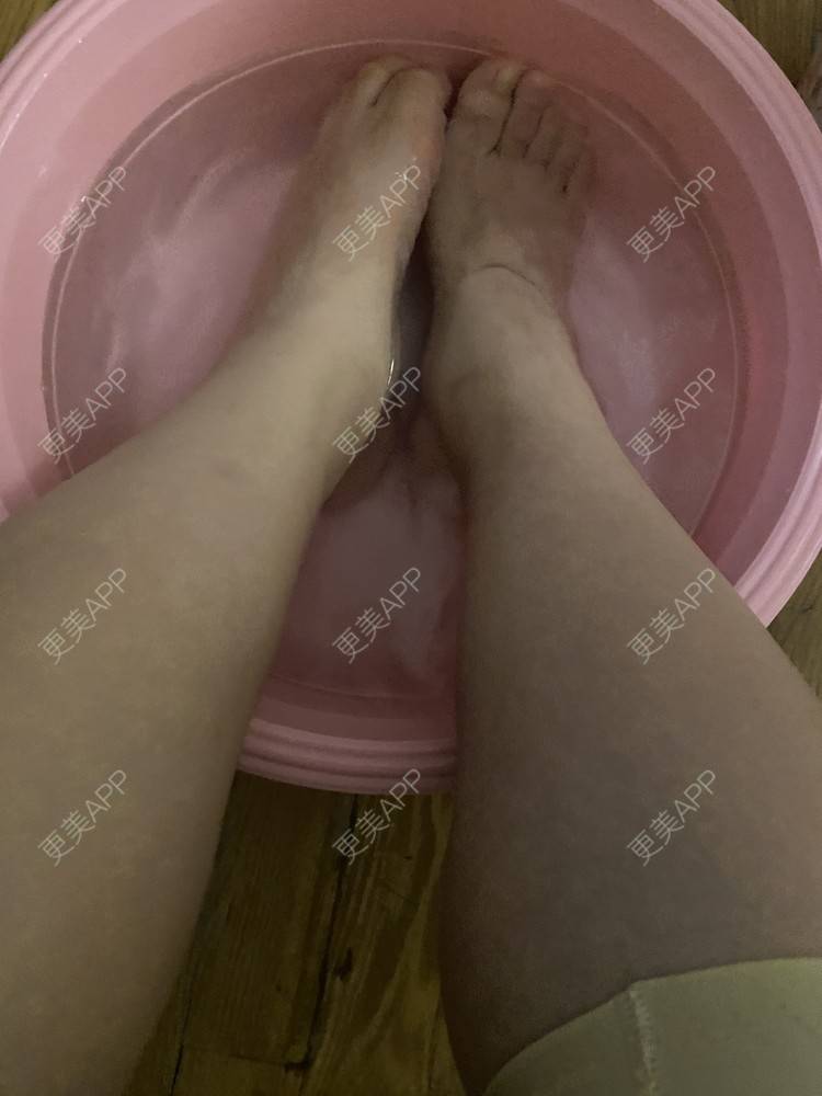 更美 - _ViViLee的吸脂经验 | 吸脂瘦大腿 | 射频溶脂瘦大腿 | 吸脂 | 上海