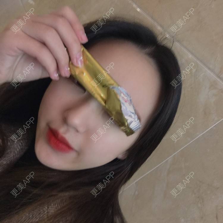 更美 - 吃飯從來用湯勺√的自体脂肪隆鼻经验 | 成都 | 自体脂肪隆鼻 | 视频日记