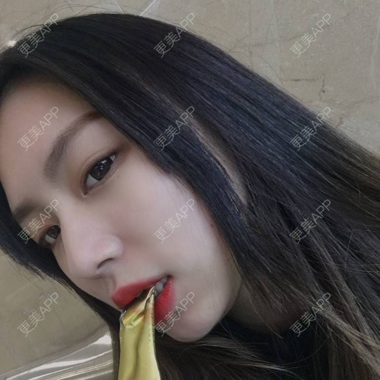 更美 - 吃飯從來用湯勺√的自体脂肪隆鼻经验 | 成都 | 自体脂肪隆鼻 | 视频日记