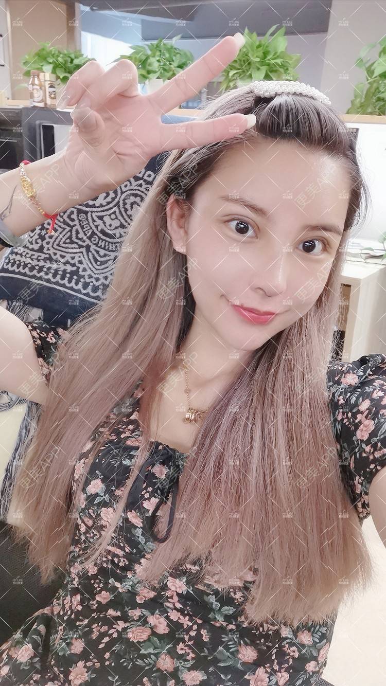 更美 - 土豆泥泥泥的双眼皮经验 | 双眼皮 | 隆鼻 | 苏州 | 自体脂肪面部填充