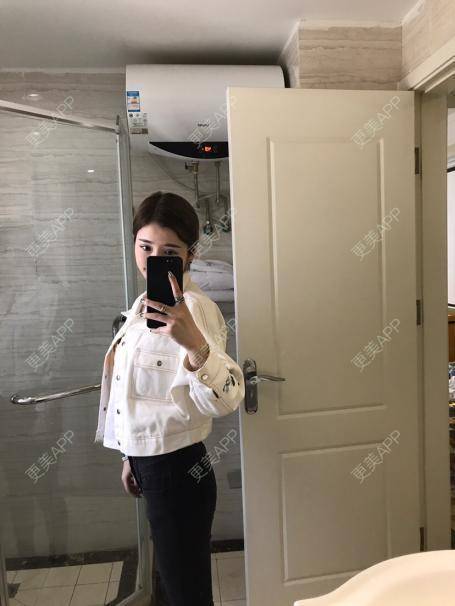 更美 - 小小小云呀的超声溶脂瘦大腿经验 | 超声溶脂瘦大腿 | 吸脂瘦大腿
