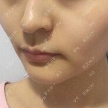 更美用户XSgnrDq4CG