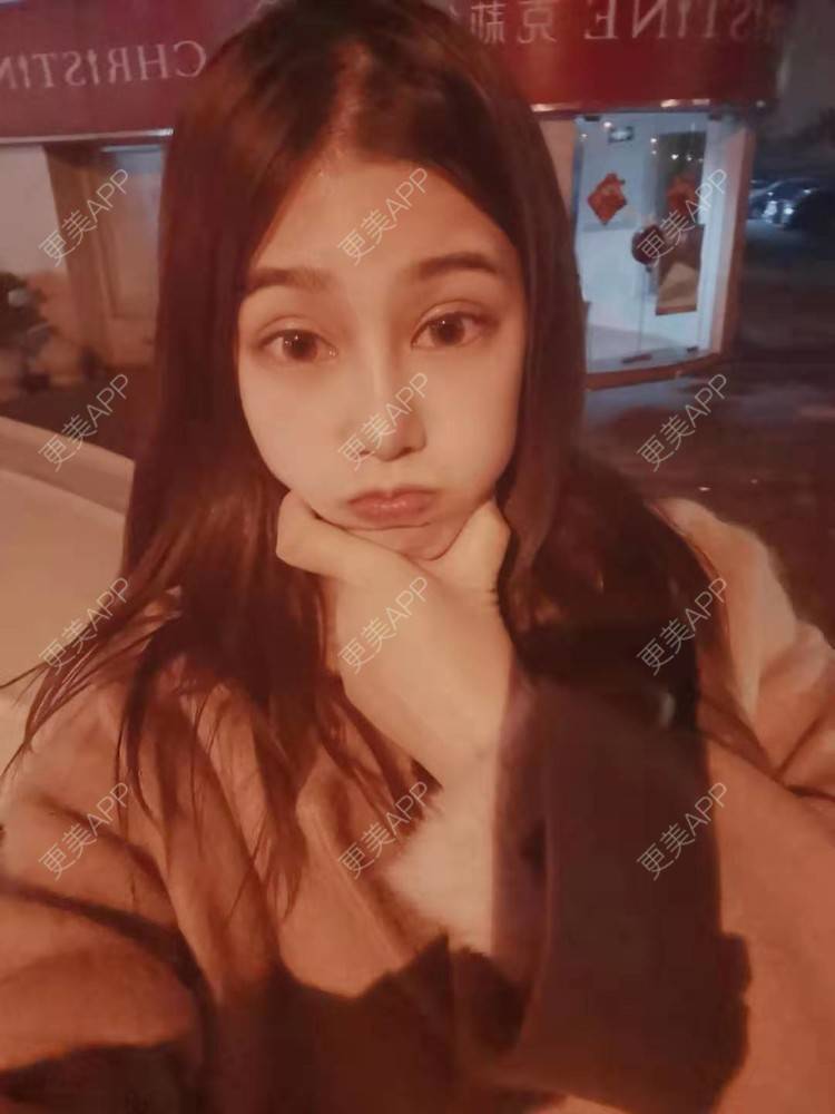 更美 - 请多多关照☞的眼部多项经验 | 上海 | 眼部多项 | 视频日记