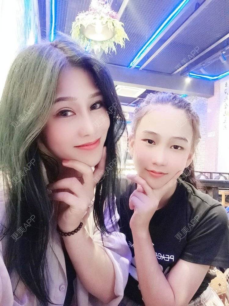 更美 - 请多多关照☞的鼻部多项经验 | 上海 | 视频日记 | 鼻部多项