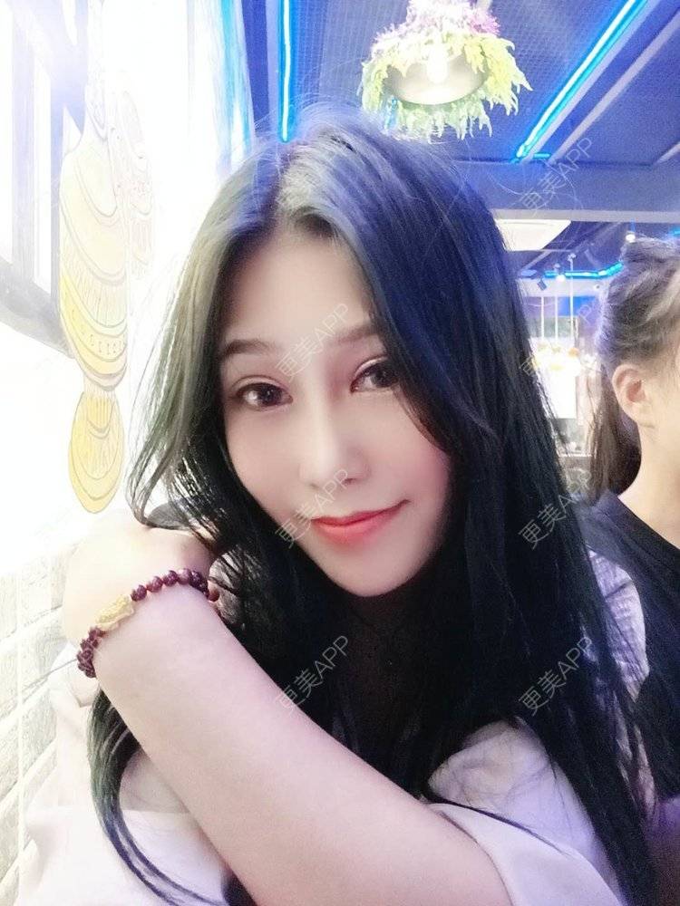 更美 - 请多多关照☞的鼻部多项经验 | 上海 | 视频日记 | 鼻部多项