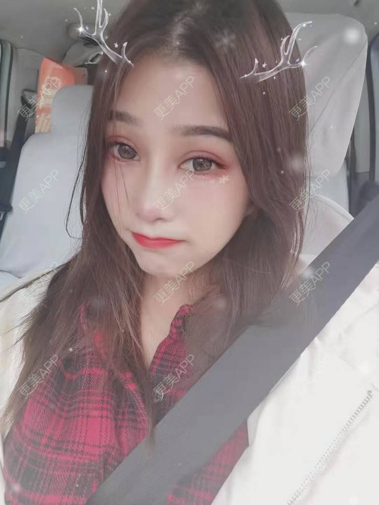 更美 - 请多多关照☞的眼部多项经验 | 上海 | 眼部多项 | 视频日记