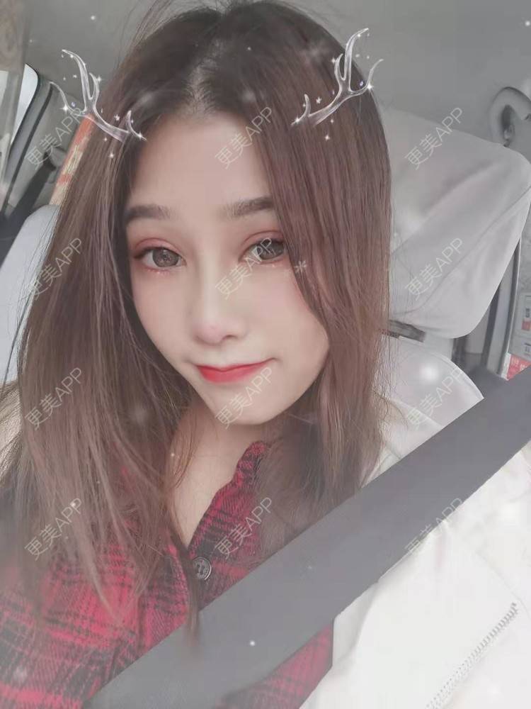 更美 - 请多多关照☞的眼部多项经验 | 上海 | 眼部多项 | 视频日记