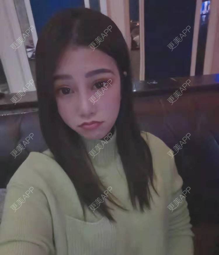 更美 - 请多多关照☞的眼部多项经验 | 上海 | 眼部多项 | 视频日记