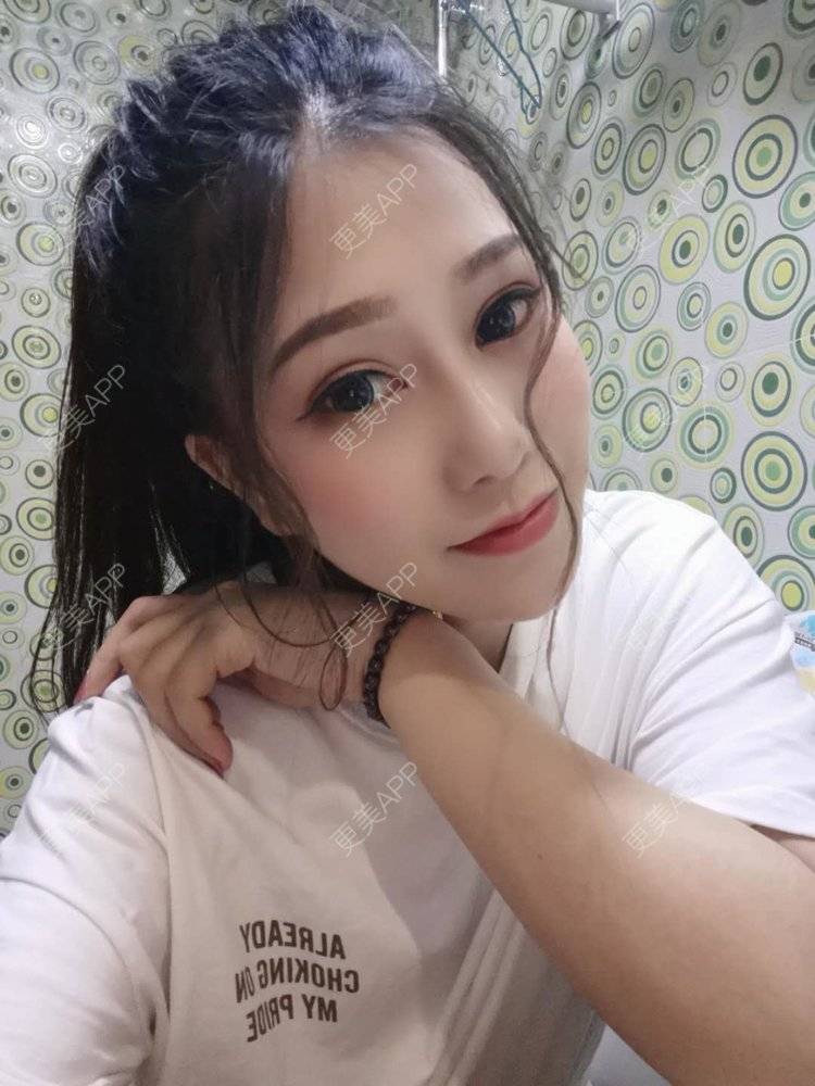 更美 - 请多多关照☞的眼部多项经验 | 上海 | 眼部多项 | 视频日记