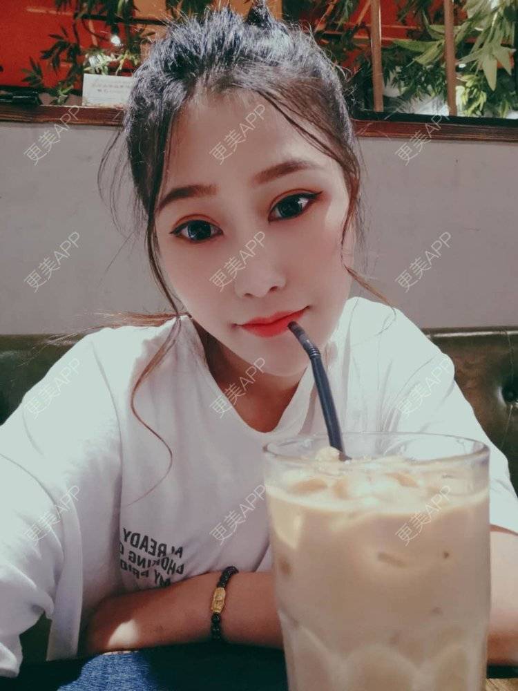 更美 - 请多多关照☞的眼部多项经验 | 上海 | 眼部多项 | 视频日记