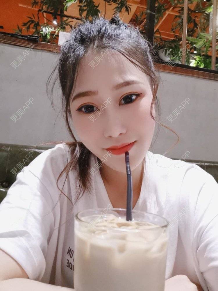 更美 - 请多多关照☞的眼部多项经验 | 上海 | 眼部多项 | 视频日记