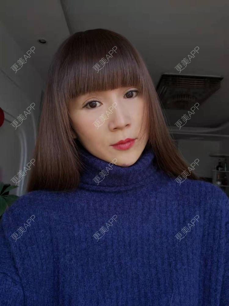 更美 - 更美用户i6Iy8EYag5的除皱经验 | 拉皮 | 小切口手术提升 | SMAS除皱手术 | 祛皱 | 除皱