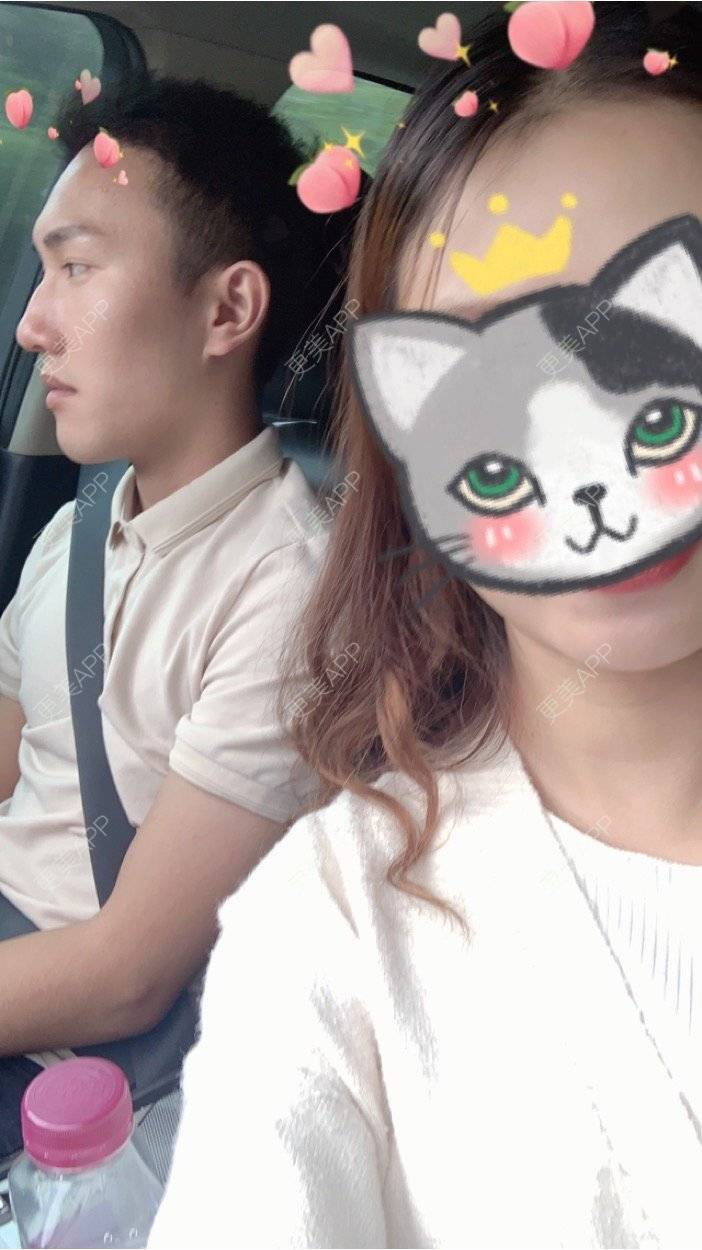 更美 - D调··的植发际线经验 | 成都