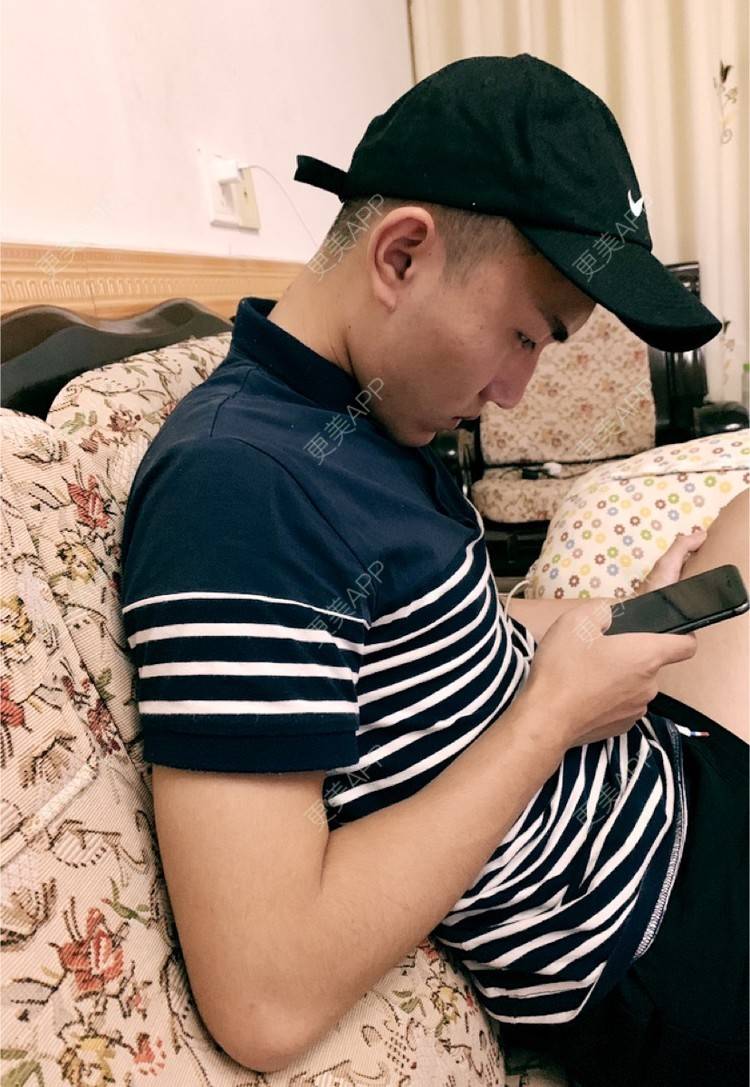 更美 - D调··的植发际线经验 | 成都