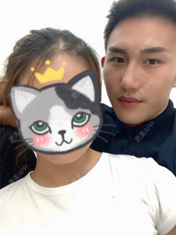 更美 - D调··的植发际线经验 | 成都