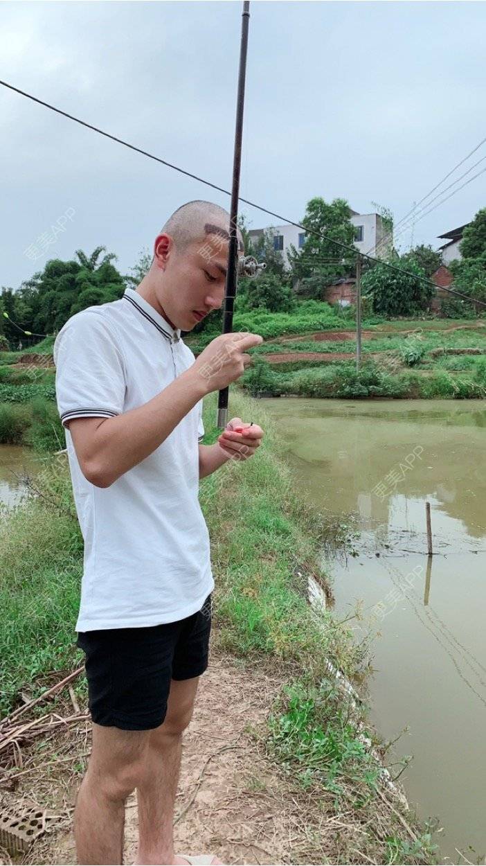 更美 - D调··的植发际线经验 | 植发际线 | 成都