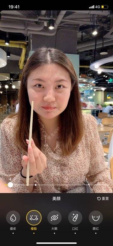 更美 - 想磨骨的飘飘的颧骨颧弓经验 | 视频日记 | 颧骨内推 | 颧骨颧弓整形 | 下颌角切除 | V脸套餐 | 上海
